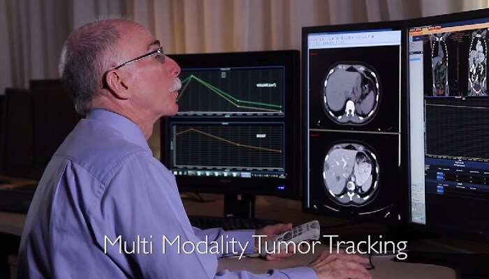 Évaluation du traitement grâce à la quantification : application Multi Modality Tumor Tracking sur IntelliSpace Portal