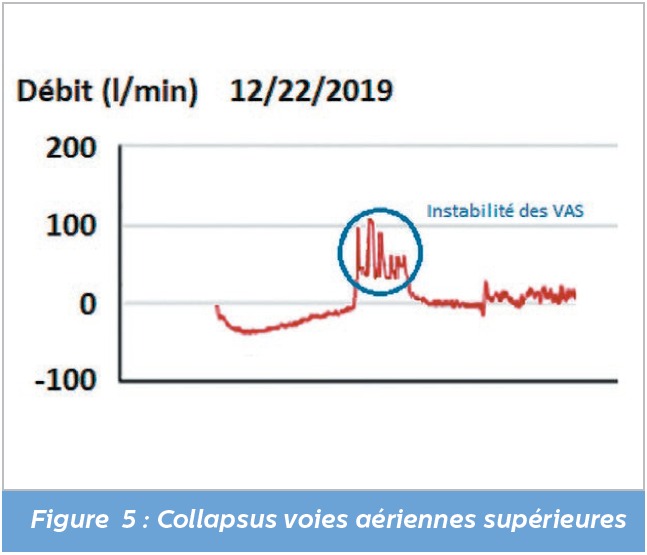 oscillations