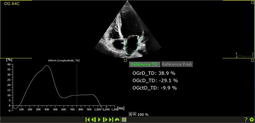 Congrès Paris Echo | Philips Healthcare