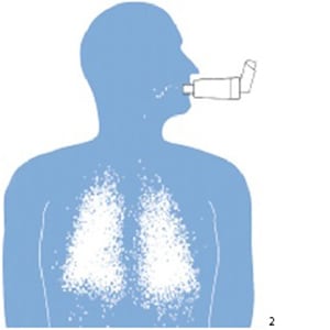 Aérosol doseur + chambre d’inhalation à valve