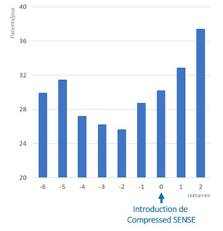 Présentation des statistiques Compressed SENSE