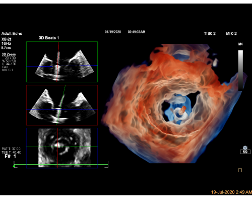 Multiclip image