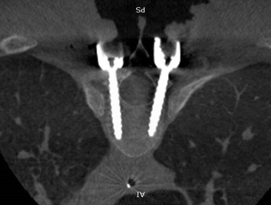 cone-beamct-confirm-phase