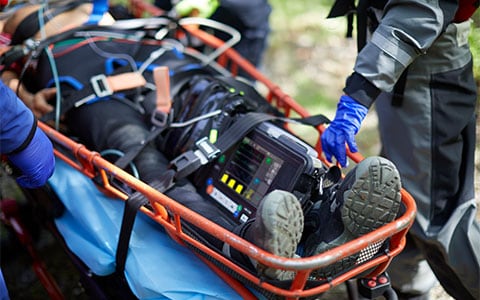 Un examen rápido de ECG