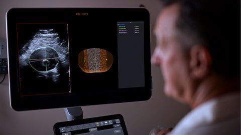 Anévrisme de l'aorte abdominale : l’apport de l’échographie 3D
