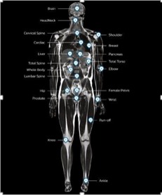 Cartographie anatomique IRM FieldStrength