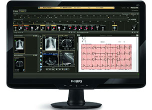 Électrocardiographe des patients suivi par le système d’information cardiovasculaire de Philips
