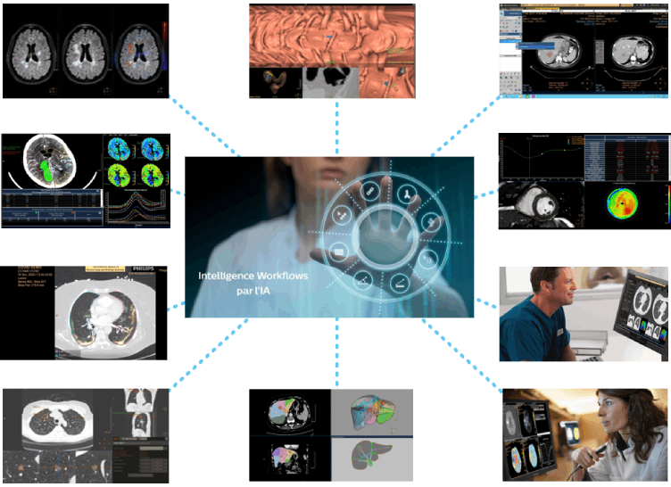 L’intelligence artificielle workflow