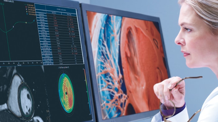 IntelliSpace Portal 12