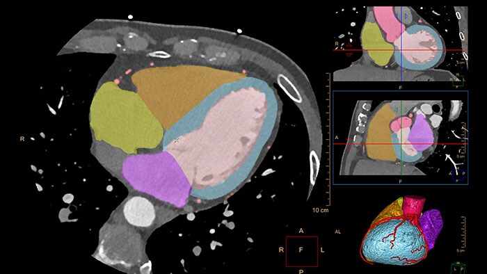 Vignette comprehensive cardiac analysis