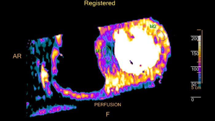 miniature dynamic myocardial perfusion