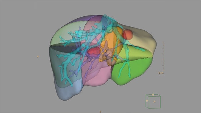 Vignette 3d modeling