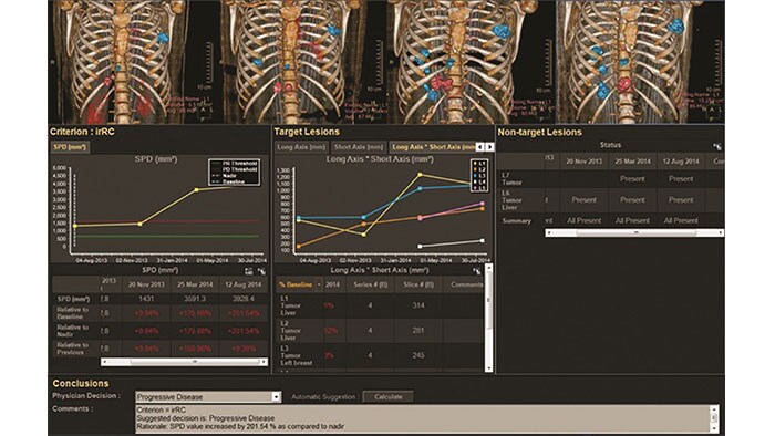 miniature tumor tracking