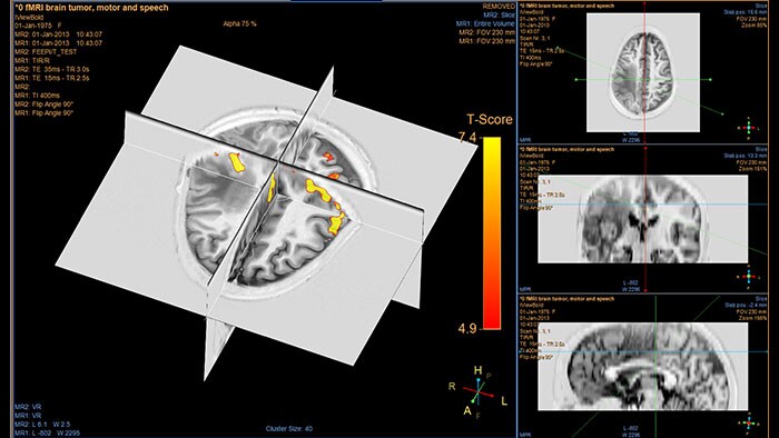 miniature multi modality viewer