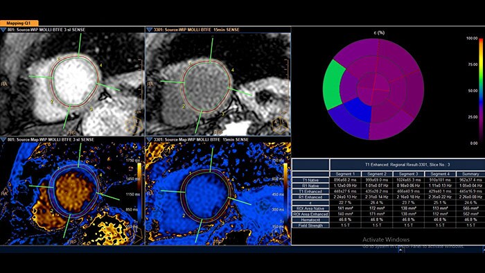 miniature cardiac quantitative mapping