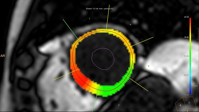 miniature cardiac temporal enhancement