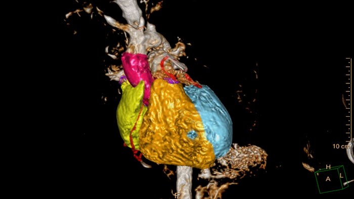 miniature cardiac whole heart