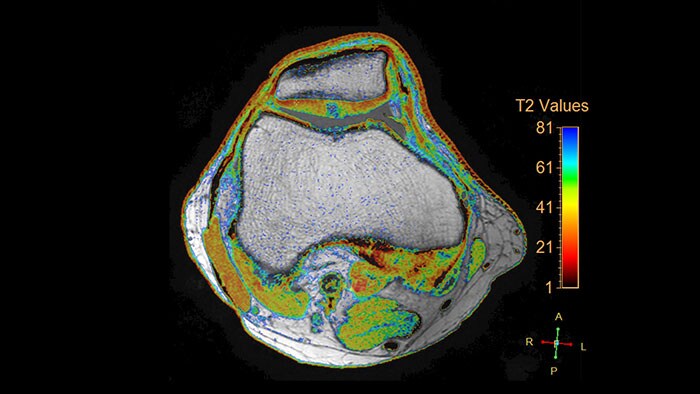 miniature cartilage assessment