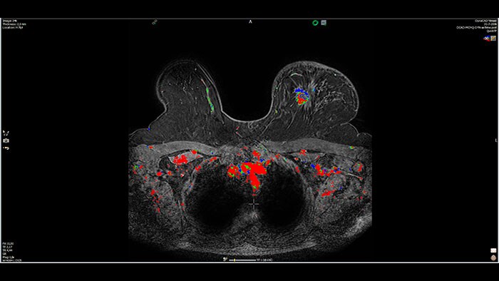 miniature dynacad breast