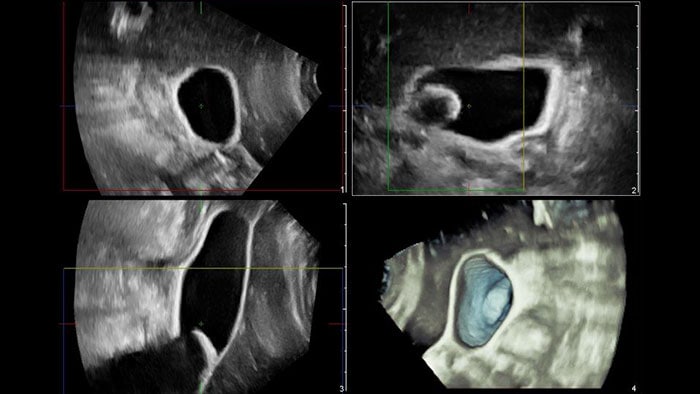 miniature Q-App General Imaging 3D Quantification