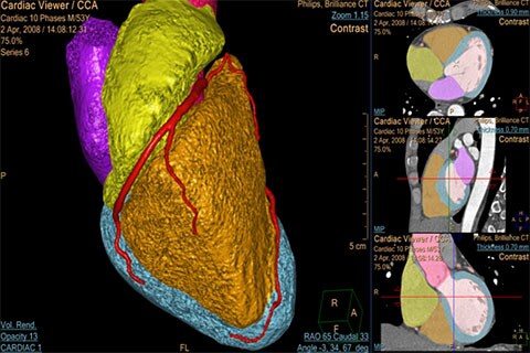 image clinique de ct comprehensive cardiac analysis