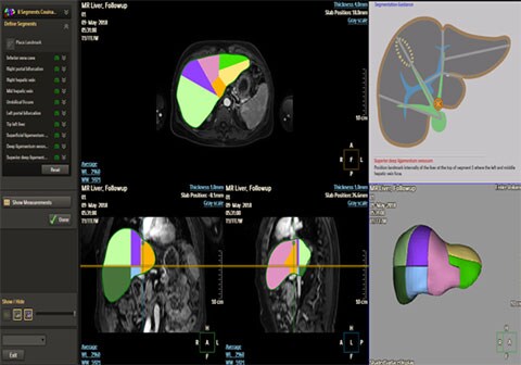 image clinique de mr liver health