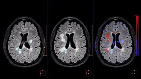 image clinique de mr longitudinal brain imaging