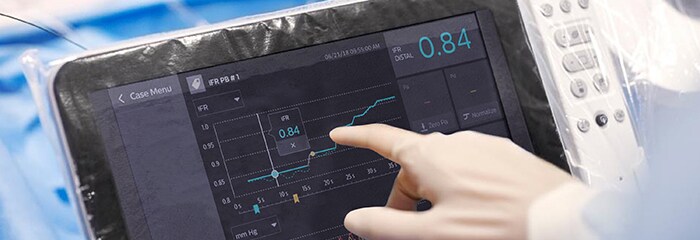 Cad treatment popup iFR mobile