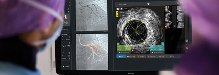 Cad treatment popup intrasight mobile