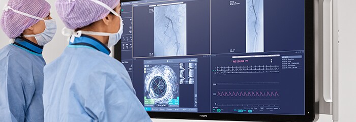 Cad treatment popup ivus mobile