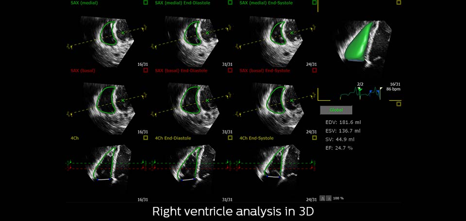 analyse vd 3d