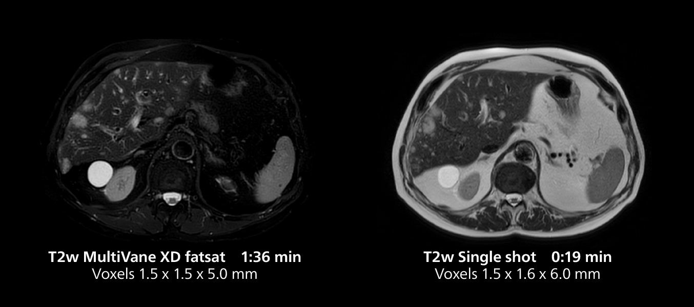 Irm du genou trois mri