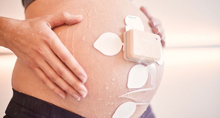 une femme enceinte avec un appareil attaché à son ventre
