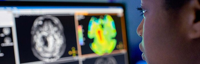 Bloc générique RSNA