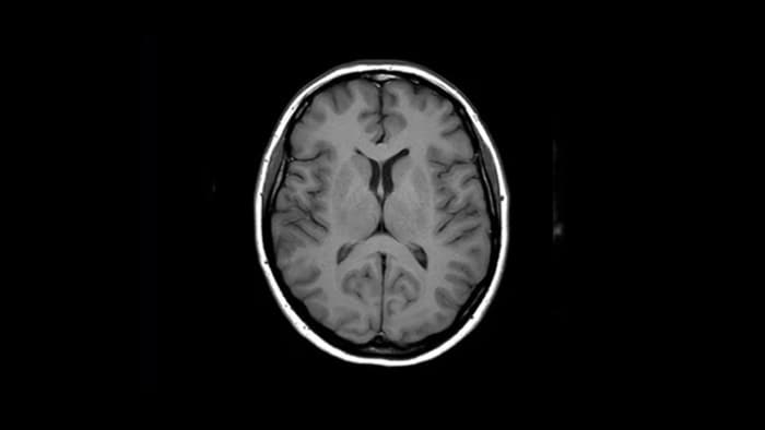 Image clinique du cerveau