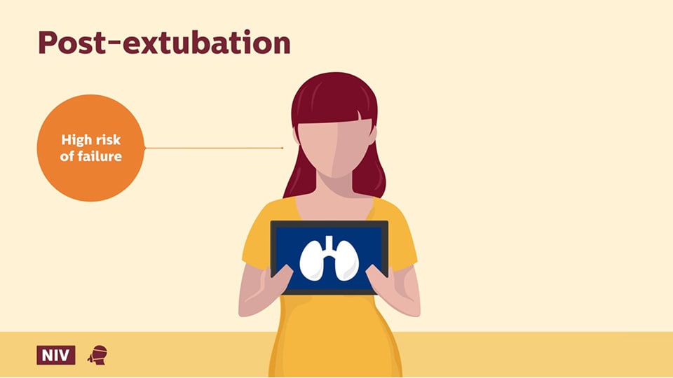 Post-extubation question video