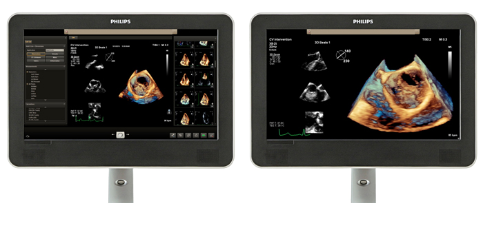 Comparaison de la zone de visualisation avec une image échographique de cardiologie sur écran