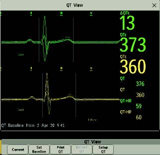 /content/dam/b2bhc/master/feature details/pm deepdive/clinical decision support technology page/CC_PM_Aide_memoire_Monitorage_de_l_