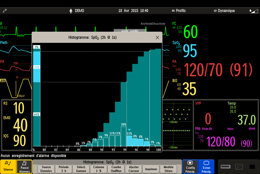 Cds histogram trends