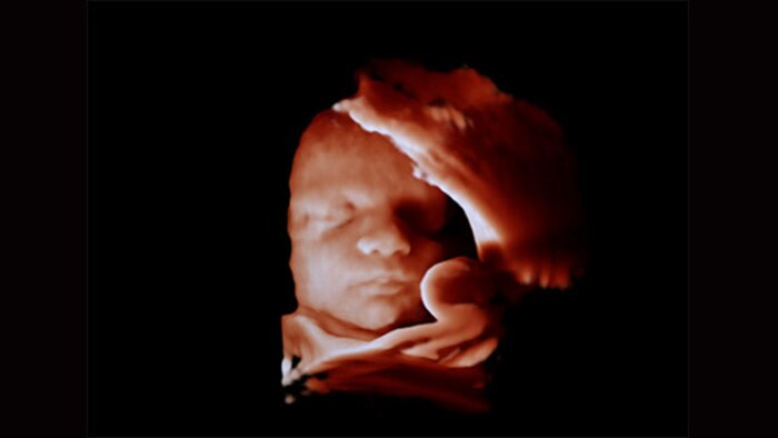 ultrasound-image