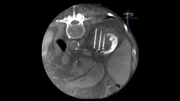 Image 3D CBCT avec double affichage