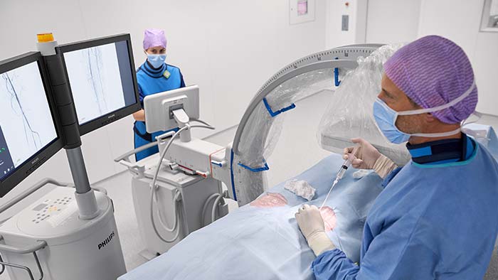 Arceaux mobiles pour les procédures vasculaires