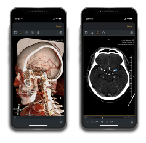 Application de neurologie
