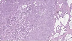 Conversion à la pathologie numérique