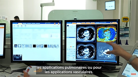 Hospices Civils de Lyon. Innovation et recherche en imagerie 