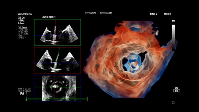 Technologie cardiaque avancée