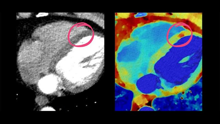 Outil de diagnostic cardiaque