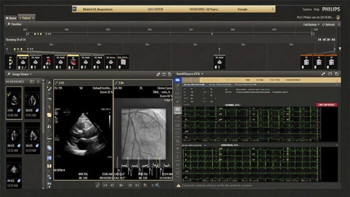 Informations sur le diagnostic cardiovasculaire