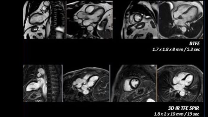 Imagerie diagnostique de qualité