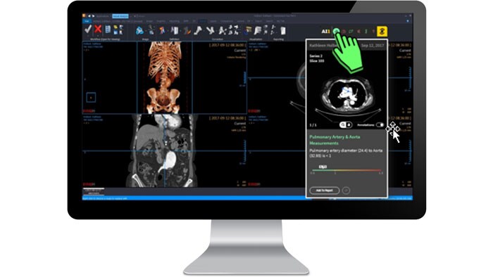 Écran d’interface d’analyse clinique sur un moniteur